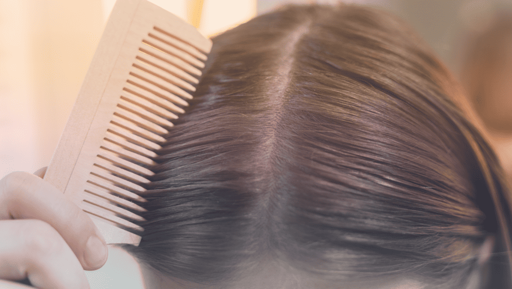 How To Tell If Your Scalp is Healthy